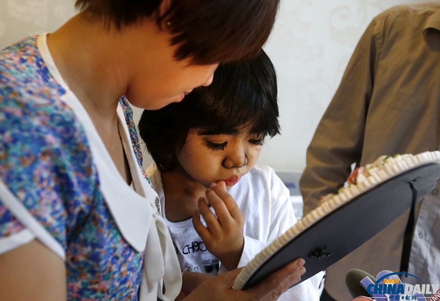 杭州：10歲輟學“毛孩”受關愛 接受面部激光脫毛