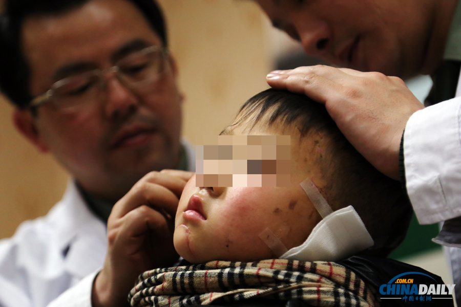 6歲男童慘遭嬸嬸割耳續(xù)：有醫(yī)院免費為他造左耳