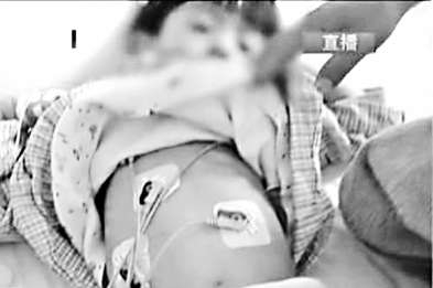 昆明疑被灌汞男童今天做手術 警方已立案調查