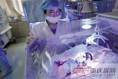 23周!重慶第一早產兒“筷子寶寶”正在頑強存活著