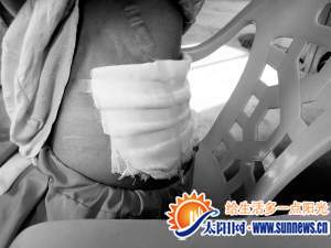 漳州一初中老師扔泡面燙傷學(xué)生 教育局今日展開(kāi)調(diào)查