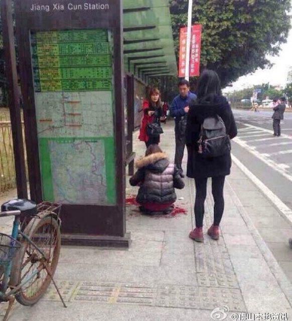 廣東佛山一女子等車遇搶劫被砍10多刀 雙手被砍爛