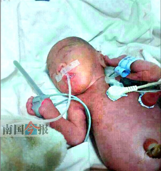 困難員工孩子出生不足1公斤 治療費要10多萬