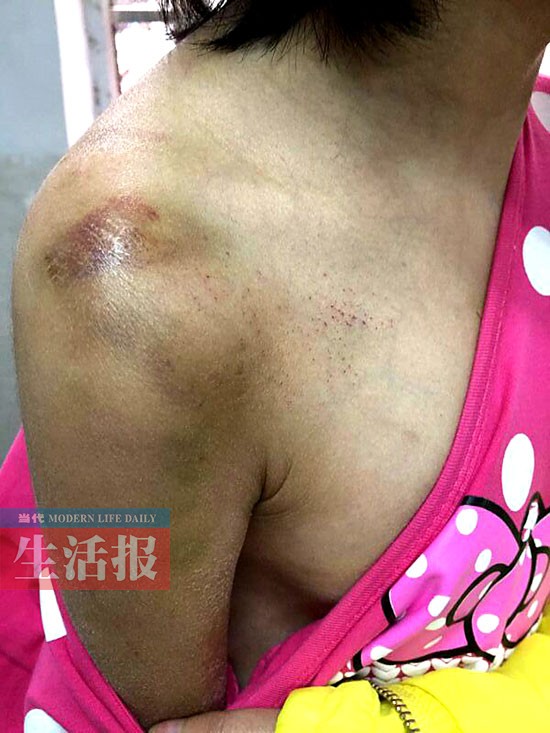 女童常常被“阿姨”毆打 連鄰居都看不過(guò)眼了