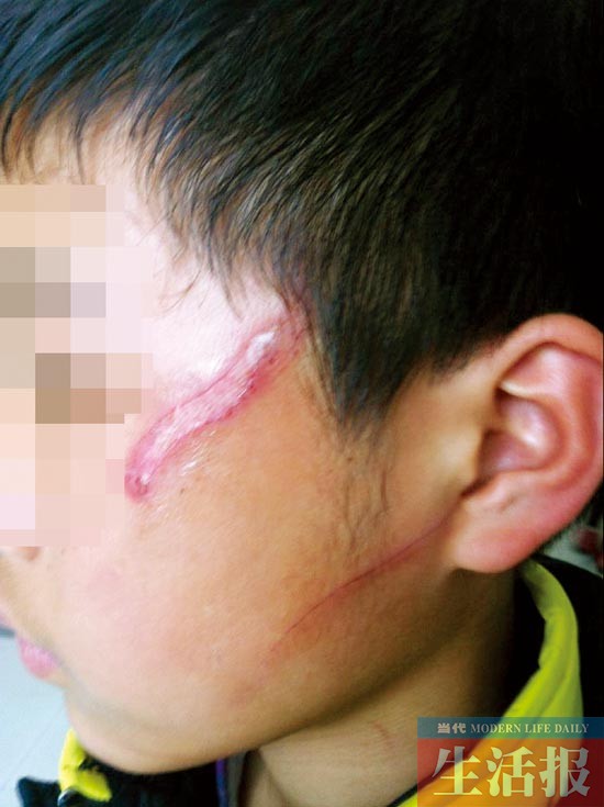 孩子連續(xù)3天打同學(xué) 淘氣鬼怎么教受氣包怎么安慰?