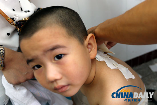 入伏第一天 各地忙貼“三伏貼”