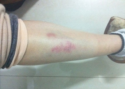 孫紅雷小沈陽打架高峰斗歐 揭娛樂圈打人事件(圖)