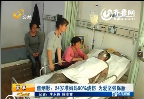 濰坊24歲準媽媽全身90%燒傷 丈夫婆婆離世為愛堅強保胎