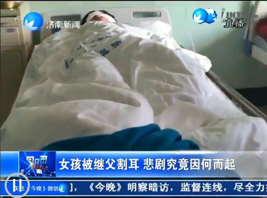 濟(jì)南一初中女生被繼父割耳朵 疑因家庭瑣事