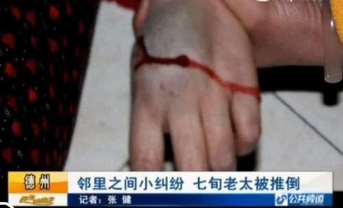 德州:因小孩動靜大鄰居鬧糾紛 七旬老太被推倒摔傷