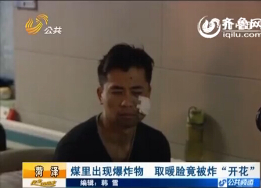 菏澤:煤里出現爆炸物 取暖臉竟被炸“開花”