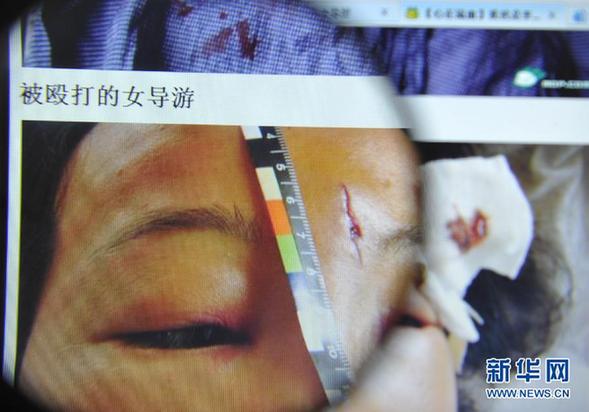 安徽黃山:一富家子弟毆打女導(dǎo)游引發(fā)爭(zhēng)議