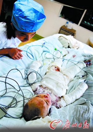 惡父多次開水燙七歲女兒續 父親或判2至7年(圖)