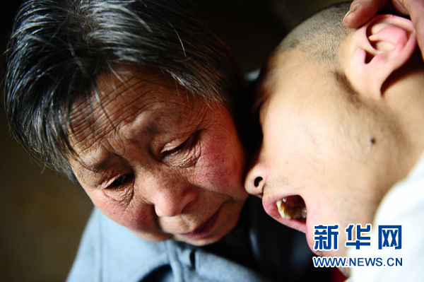 青海夫婦32年撫養腦癱棄兒托起生命之光