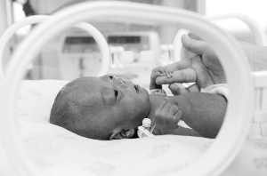 近50歲媽媽早產“拇指姑娘”:手掌僅指甲大小