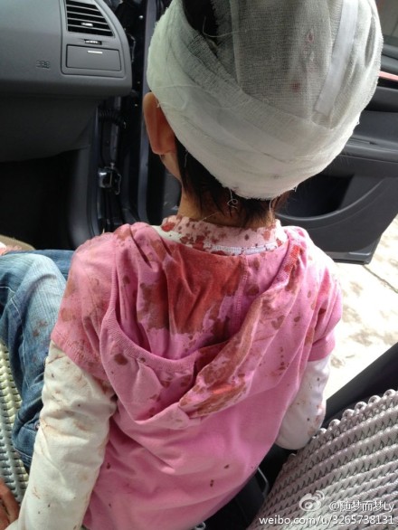 現場：受傷小女孩堅強微笑感動網友（圖）