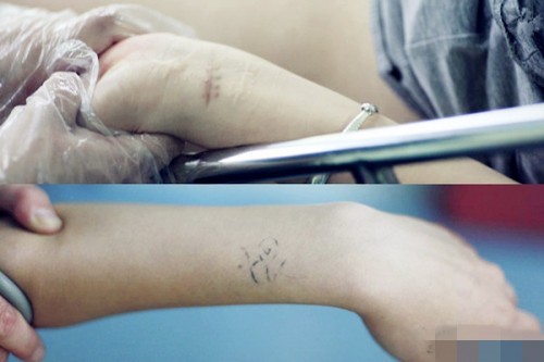 5位前男友不知誰是孩兒爸陪同人流 揭秘少女人流現場(圖)