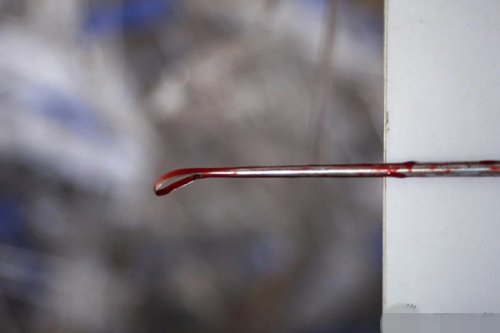 5位前男友不知誰是孩兒爸陪同人流 揭秘少女人流現場(圖)