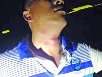 公園道路上突然攔了鐵絲網市民差點被“鎖喉”