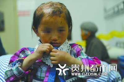 貴州針扎縫嘴虐女案續：涉案父親獲刑1年6個月