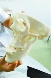 患罕見“長臉癥” 大二男孩不再自卑手術整形