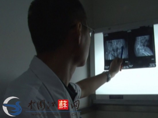 江蘇淮安女嬰體內(nèi)取出4根縫衣針 或?yàn)槿藶樵?/></font></p>

<p align=