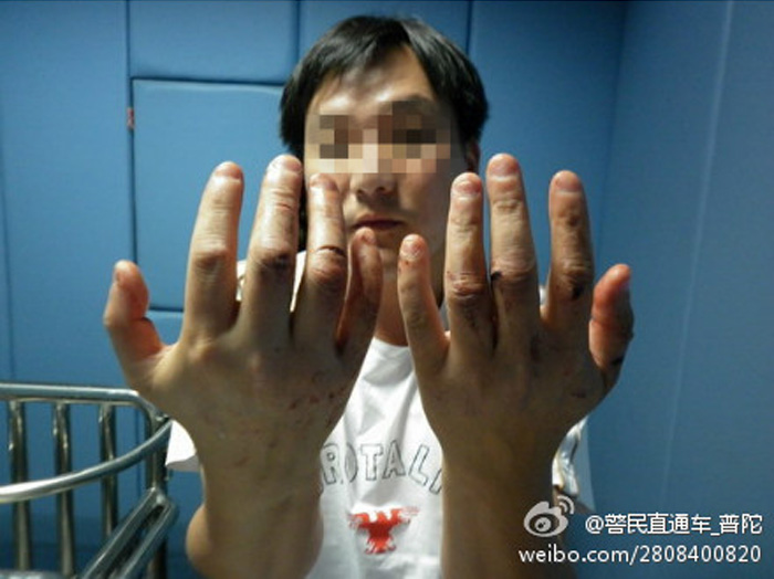 男子車被擋道用拳頭 怒砸15輛車