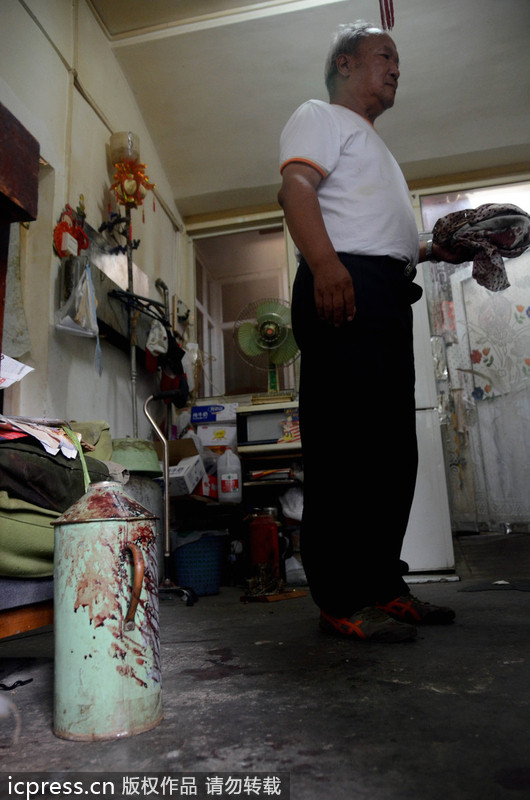 北京一老太因養狗起沖突 九旬奶奶被咬受傷