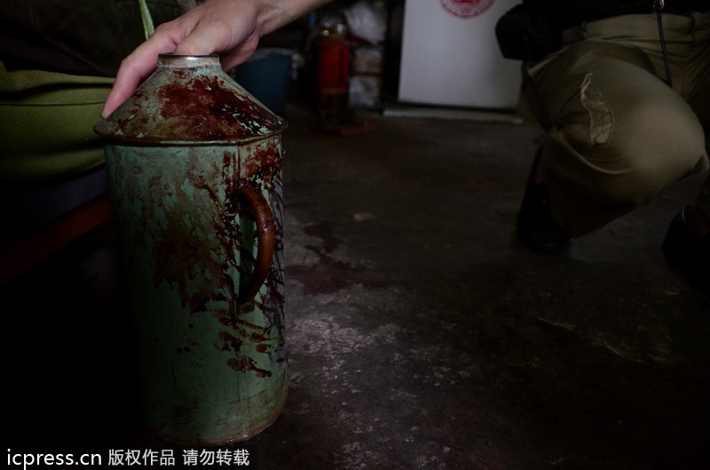 北京一老太因養(yǎng)狗起沖突 九旬奶奶被咬受傷