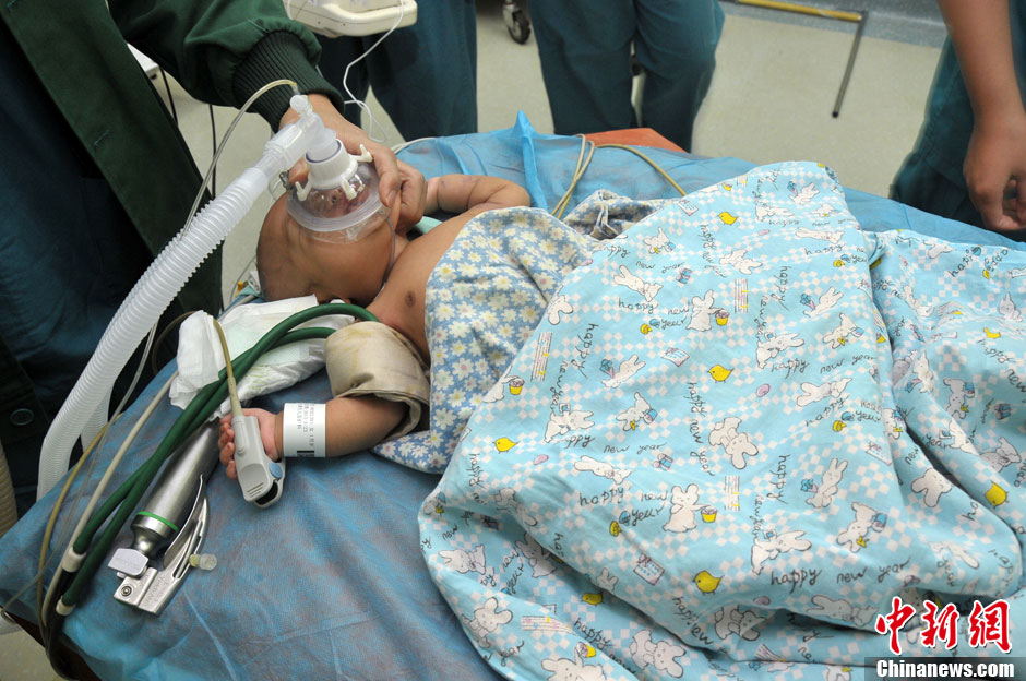 黑龍江被“縫衣針”扎傷女嬰手術成功