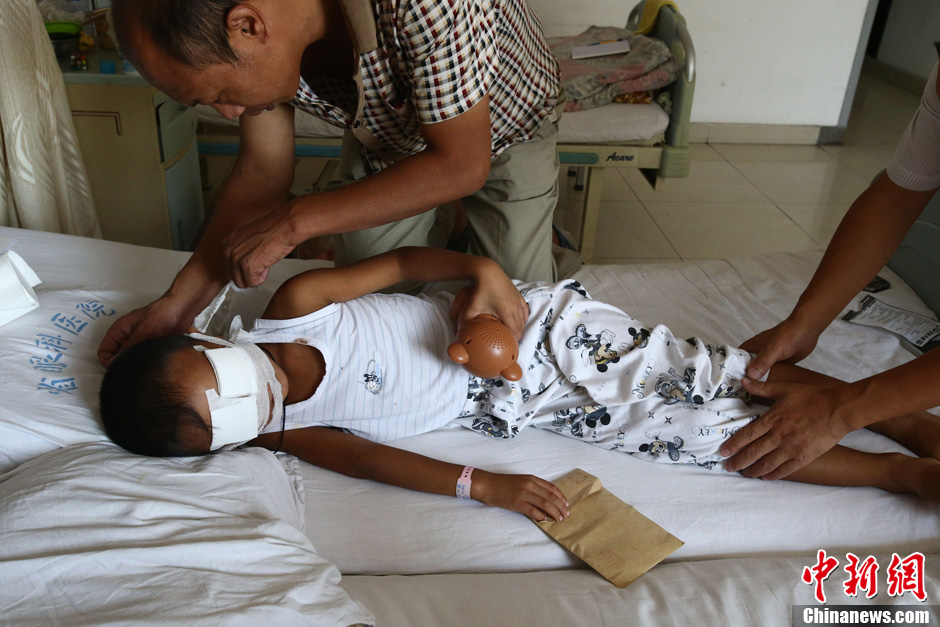 山西被挖雙眼男童進行行走復健