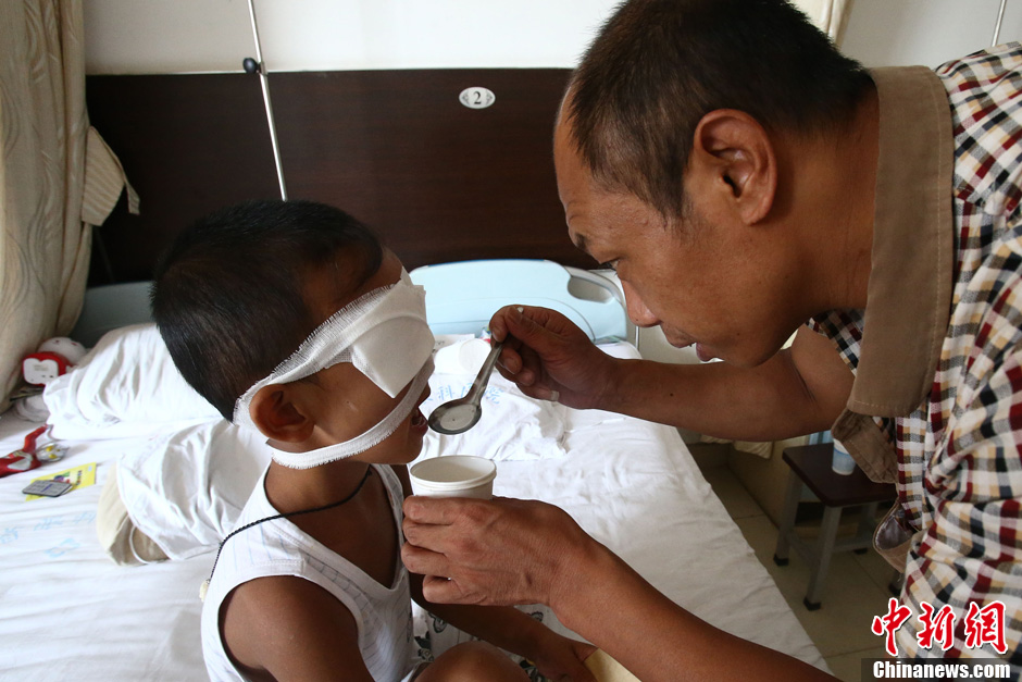 山西被挖雙眼男童進行行走復健