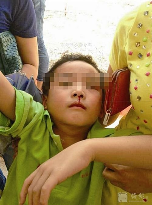 組圖：浙江19名小學生流鼻血近百人嘔吐 矛頭指向附近工廠