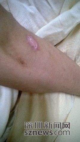 男子街頭遭兩名便衣警察毆打后被告知抓錯人