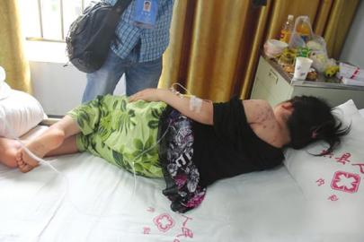 四川珙縣4名學生放學路上遭野蜂“圍攻”致1死3傷(圖)