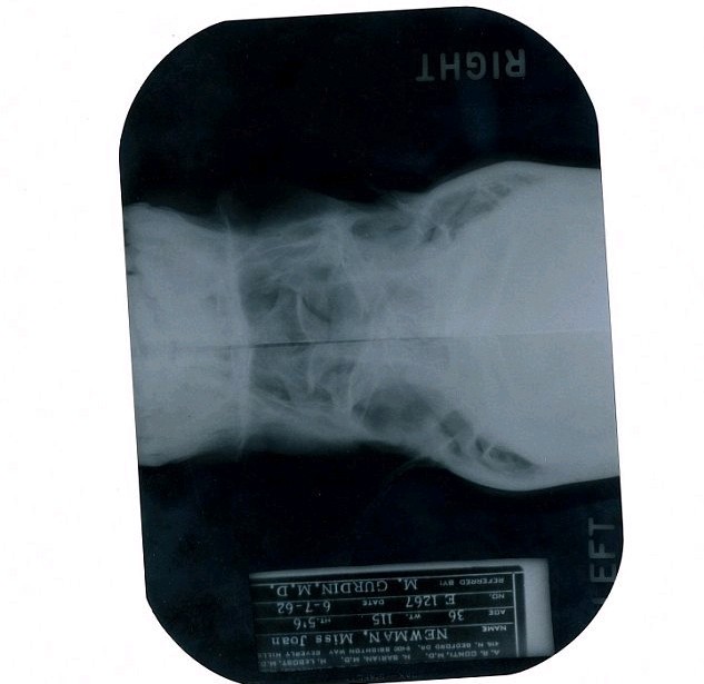 瑪麗蓮夢露被曝曾整容 X光照片將拍賣