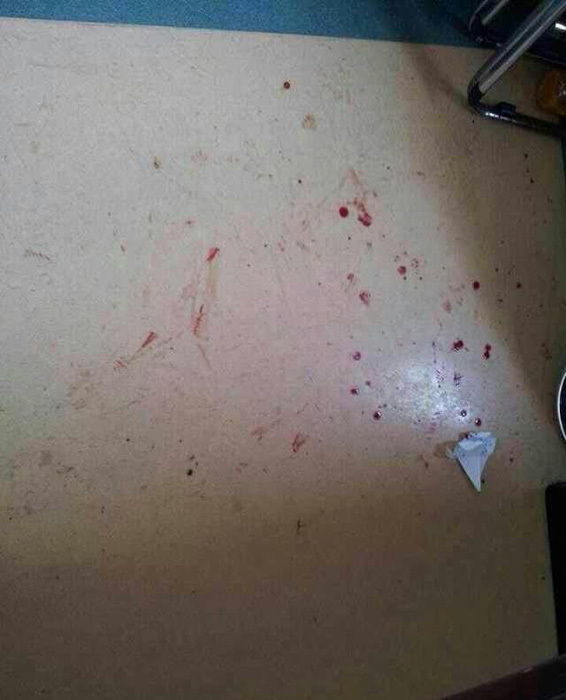 廣醫(yī)二院“抗非”英雄醫(yī)生被圍毆 因家屬欲運尸被拒