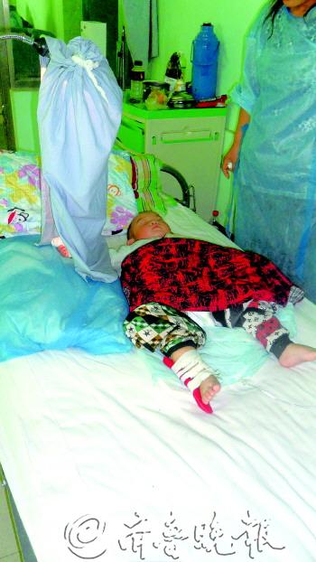 一歲娃逗兔子手指險被嚼碎 專家:養寵物要謹慎