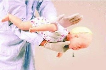 親友執(zhí)意喂食 1歲半幼女核桃仁卡住喉嚨險(xiǎn)窒息