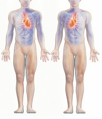 沈陽一老漢活了60年才知自己五臟六腑全部長反(圖)