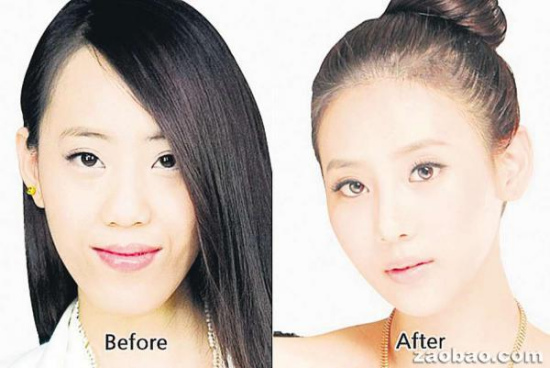 游客赴韓整容后海關認不出 韓國醫(yī)院忙著開證明