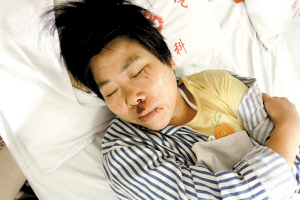 港鐵再次公布視頻截圖證清白 傷者堅稱扶梯逆行