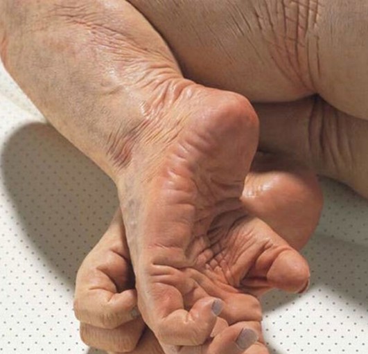 驚世駭俗的“豬人”！