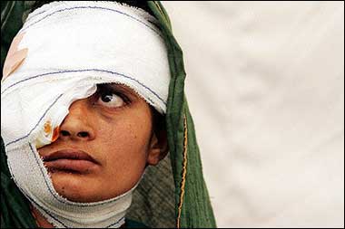 An injured Kashmiri woman waits for medicine after treatment to her head and eye at a makeshift medical center set up in Tandali village, some 20 kilometers from Muzaffarabad. The UN's top relief official warned of a 'disaster within a disaster' due to the crush of quake aid pouring into Pakistan.(AFP