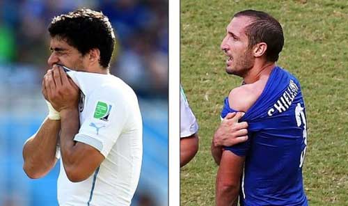 蘇神咬人的五大理由!