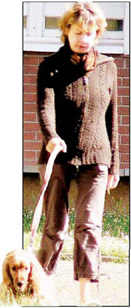 世界首例換臉手術“完美”成功(多圖)