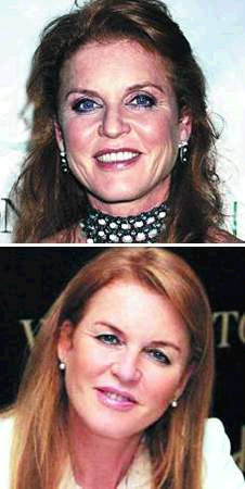 安德魯王子前妻被疑整容 美容要武裝到牙齒(圖)