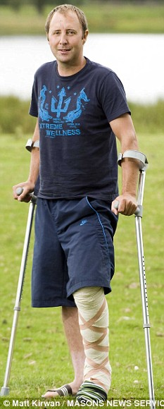 英國(guó)男子遛狗被閃電擊中 30萬伏電流過身大難不死