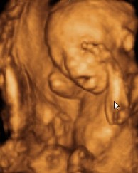 巴西學者神奇新技術可制作腹中胎兒模型