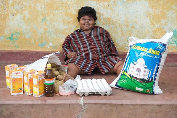 印度女孩5歲150斤醫(yī)生擔(dān)心活活吃死